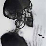 Bones